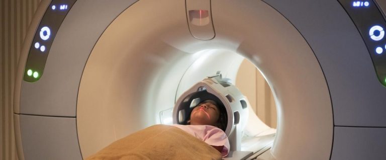 تشخیص اوتیسم به کمک MRI